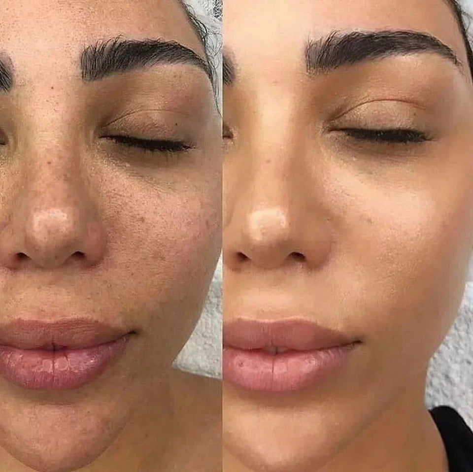 Before & After Glow: The Power of Pure, Homemade Skincare